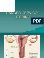 Cancer,., Cervico Uterino