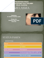 Case Melasma