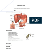 COLECISTECTOMIA