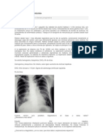 Casos Clìnicos de Neumologìa