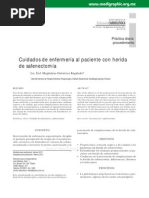 Cuidados de Enfermería en Pacientes Con Safenectomia