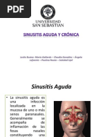 Patologia Sinusitis