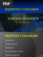 Injertos y Colgajos