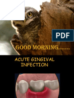 Acute Gingival Infections