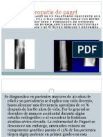 Osteopatía de Paget