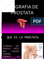 Prostata