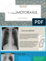 Pneumotorax, Chirurgie, Generalitati