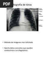 RX Torax Normal