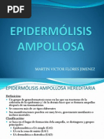 Epidermólisis Ampollosa