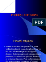 Pleural Effusions