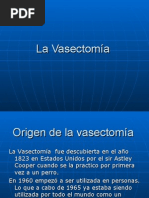 La Vasectomía