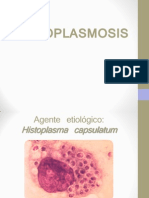 Histoplasmosis Grupo A