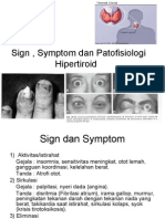 Tanda, Gejala Dan Patofisiologi Hipertiroid