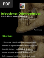 Via Difusion Infeccion Maxilofacial Maxillofacial Surgery Infection