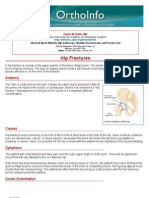 Hip Fractures-Orthoinfo - Aaos