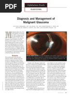 Diagnosis and Management of Malignant Glaucoma