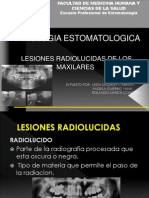 Radio Lucido