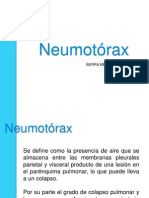 Neumotorax Alfio