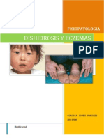 Dishidrosis y Eczemas