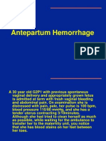 Antepartum Hemorrhage