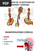 Trastorno de Motilidad Esofagica y Cancer de Esofago