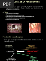 Microbiología de La Periodontitis