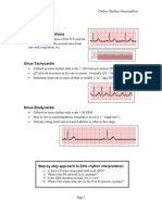 EKG Rhythms2 PDF