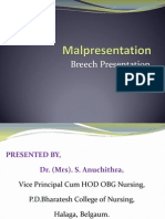 Malposition - Breech Presentation