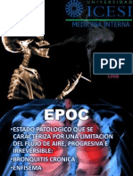 Epoc