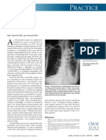 Practice: Thoracic Balls