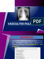 Vasculitis Pulmonares