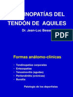 Tendinitis Aquiles