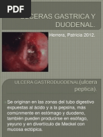 Ulceras Gastrica y Duodenal