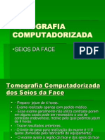 Tomografia Computadorizada