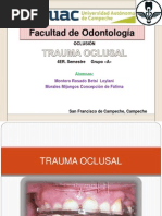 Trauma Oclusal