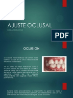 Ajuste Oclusal para Fija