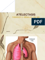 Atelectasis Edited