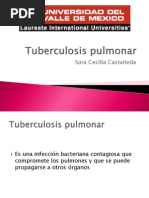 Tuberculosis Pulmonar