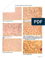 Hematology