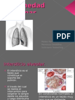 Enfermedad Intersticial Difusa