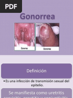 Gonorrea