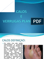 2 Calos e Verrugas Plantares