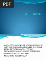 Arritmias Vene