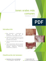 Lesiones Orales Comunes