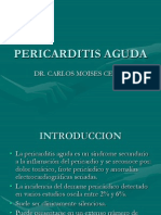 Pericarditis Aguda