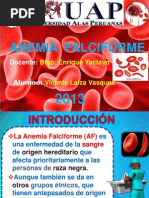 Anemia Falciforme Expo-Laiza