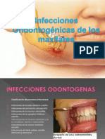 Infecciones Odontologicas de Los Maxilares