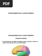 Reconocimiento Del Ataque Cerebral