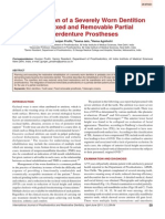 Rehab of Severley Worn Dentition-Using Fixed and Removable