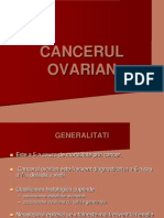 Cancerul Ovarian